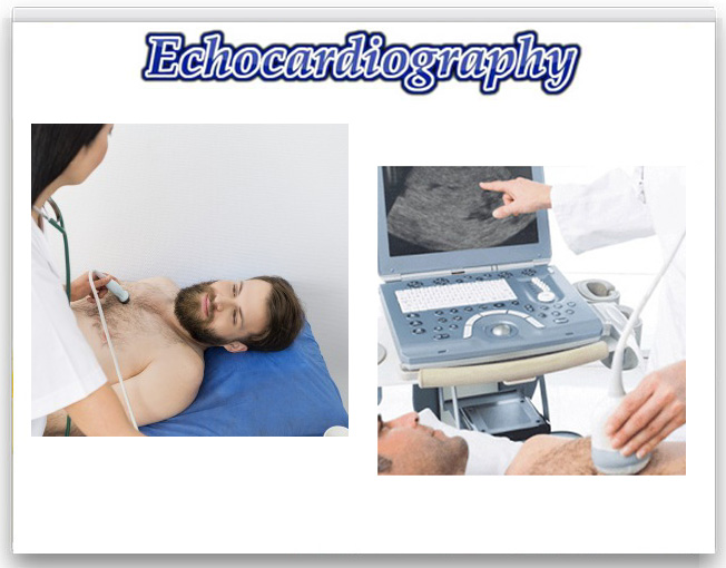 Vitaccorp Diagnostic | Echocardiography